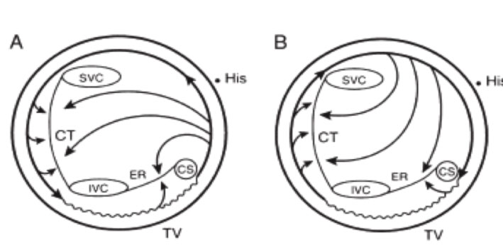 AFL substrate